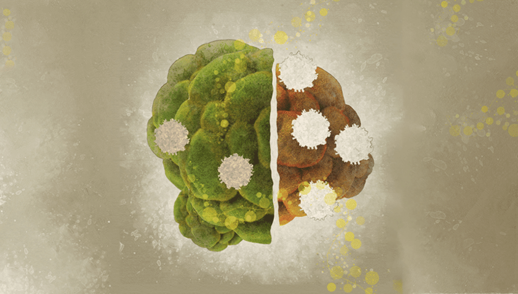 Combat entre cellules tumorales (vertes et brunes) et cellules immunitaires (blanches). Illustration : Shraddha M. Nayak et Janet Iwasa. © Harvard Medical School