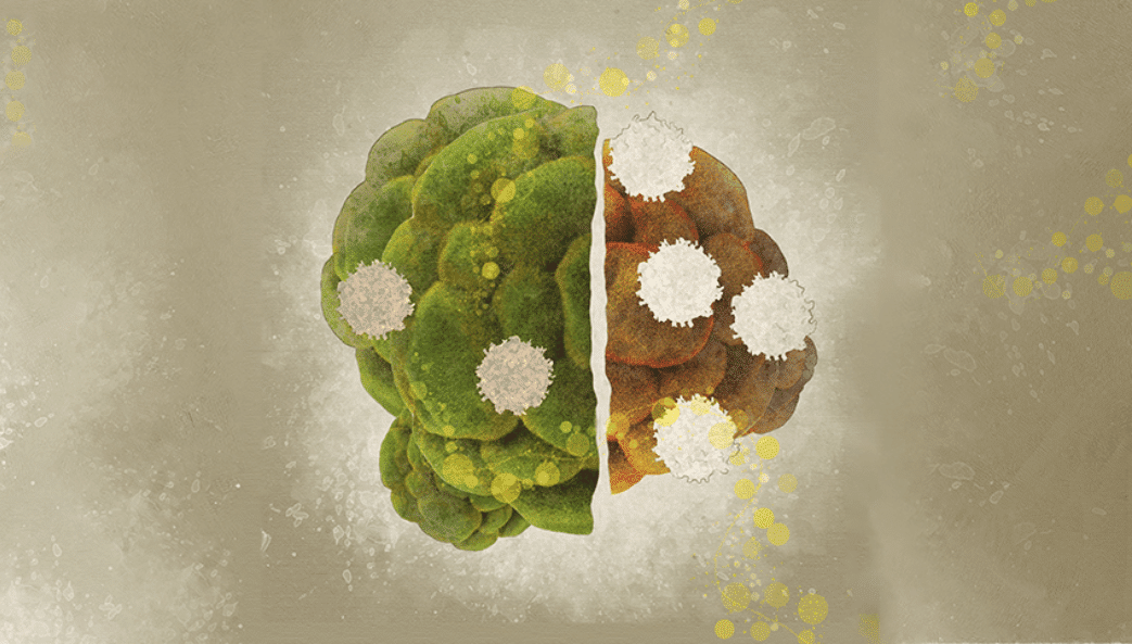 Combat entre cellules tumorales (vertes et brunes) et cellules immunitaires (blanches). Illustration : Shraddha M. Nayak et Janet Iwasa. © Harvard Medical School