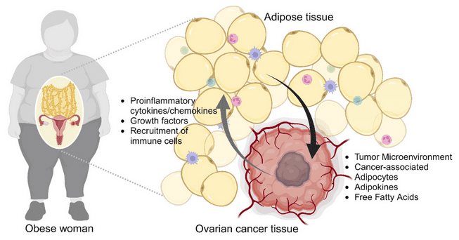 Interaction mutuelle entre tissu tumoral ovarien et tissu adipeux chez la femme obèse. Production d’un milieu proinflammatoire favorisant la progression tumorale. Kim B, Jung J. Biomedicines. 2024 Mar 7;12(3):604.