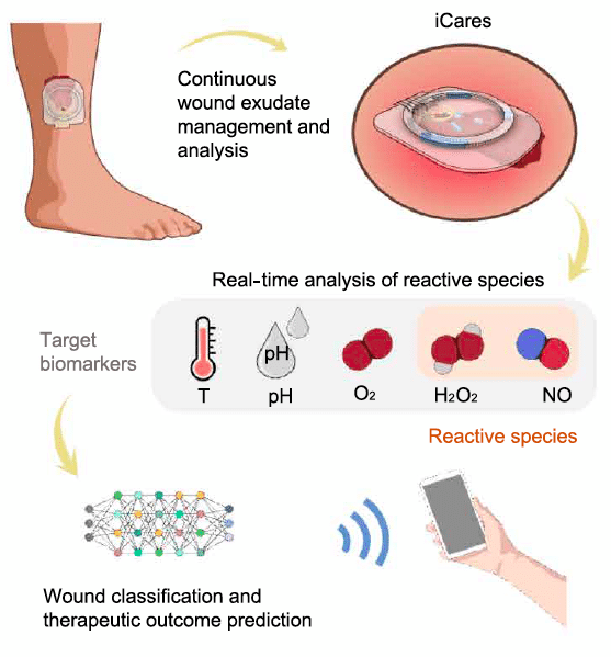 Vue schématique du système iCares appliqué sur une plaie chronique. Ce dispositif comporte un réseau de capteurs et un système microfluidique. Il intègre des modules de transmission sans fil pour une analyse en temps réel de plusieurs biomarqueurs de l’exsudat. Wang C, et al. Sci Transl Med. 2025 Apr 23;17(795):eadt0882.